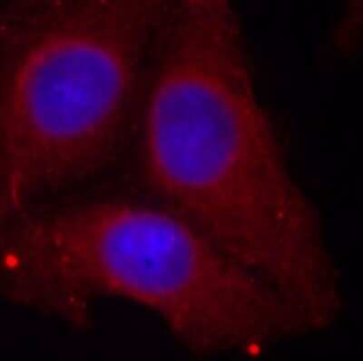 Immunocytochemistry/ Immunofluorescence: GAP-43 [p Ser41] Antibody - Azide and BSA Free [NBP3-05419]